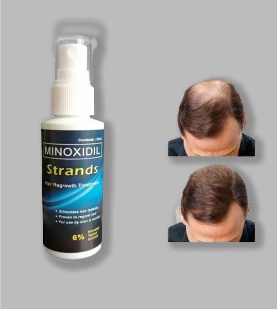 Minoxidil Topical Solution for Men 60ml